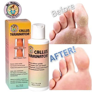 Mr. Pumice Callus Terminator 4 fl oz ( Callus Remover )